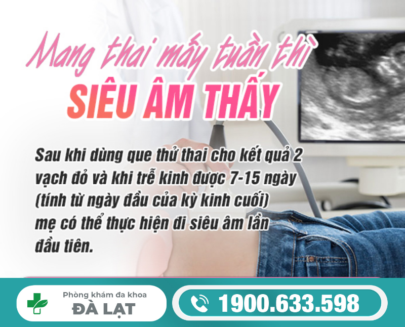 Hình ảnh minh họa